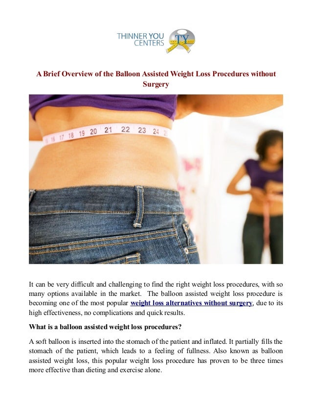 Weight loss procedures without surgery